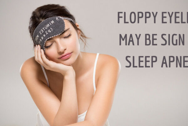 Floppy eyelids may be sign of sleep apnea